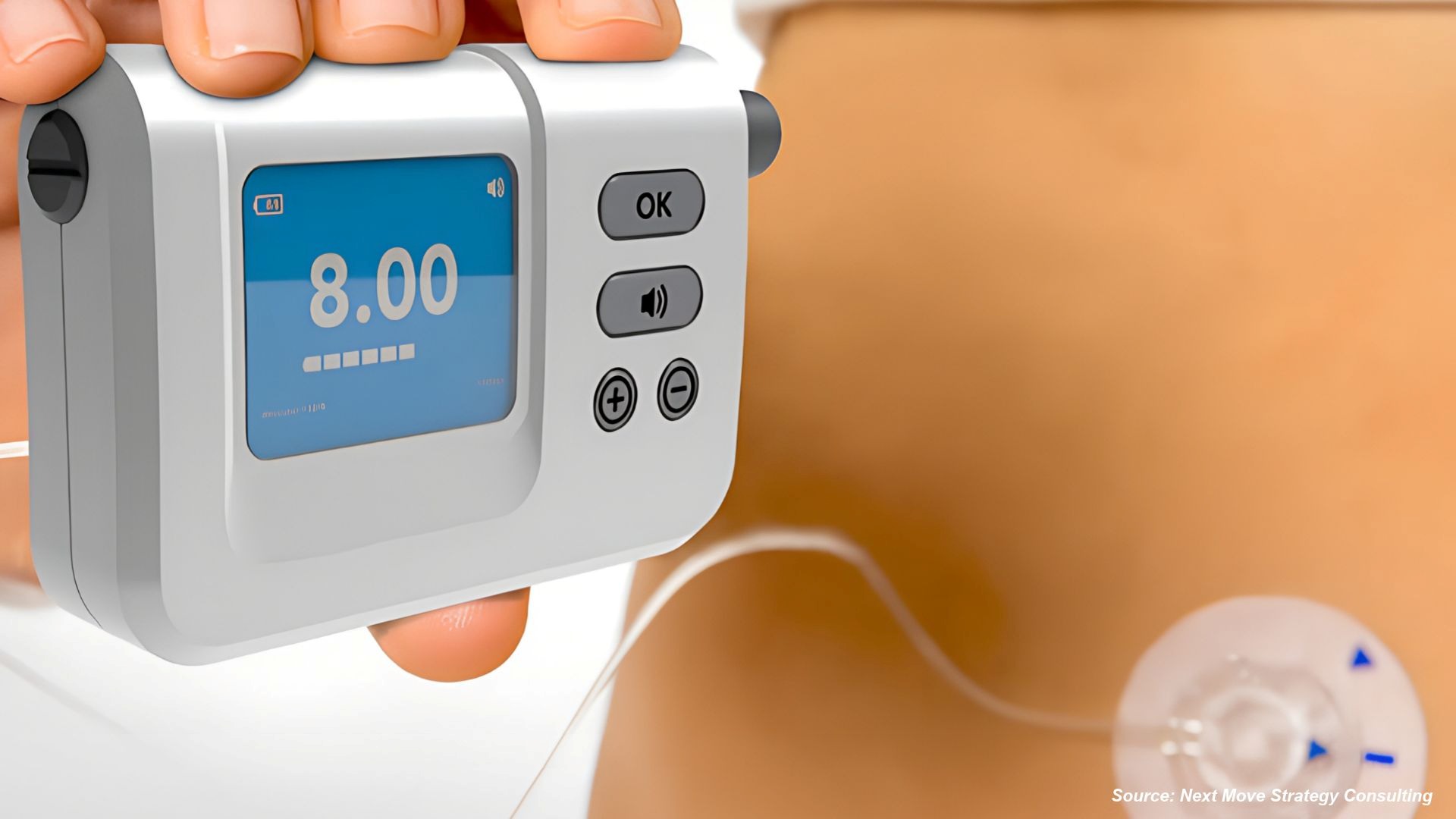 Beta Bionics' Mint FDA Clearance Signals Smarter Insulin Delivery | NextMSC