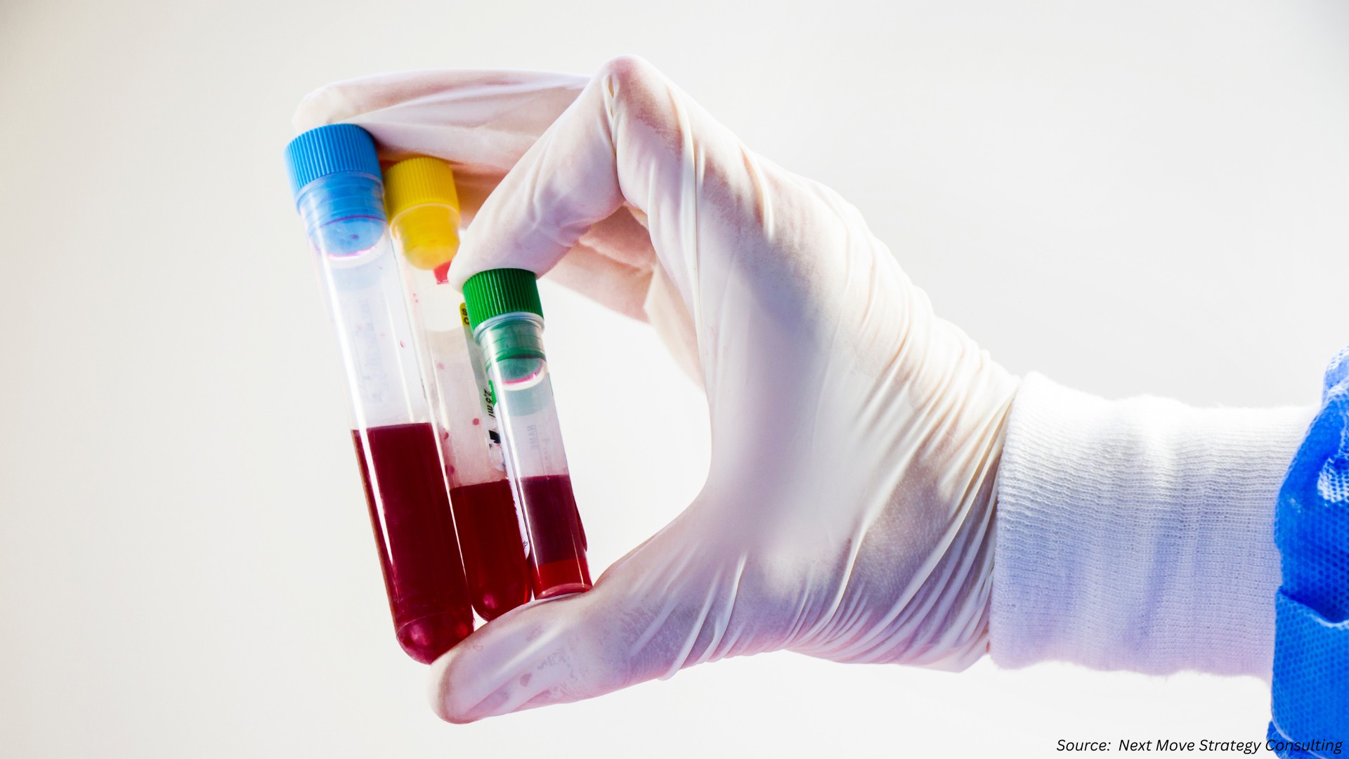 The Power of Blood Testing: Revolutionizing Healthcare in 2025