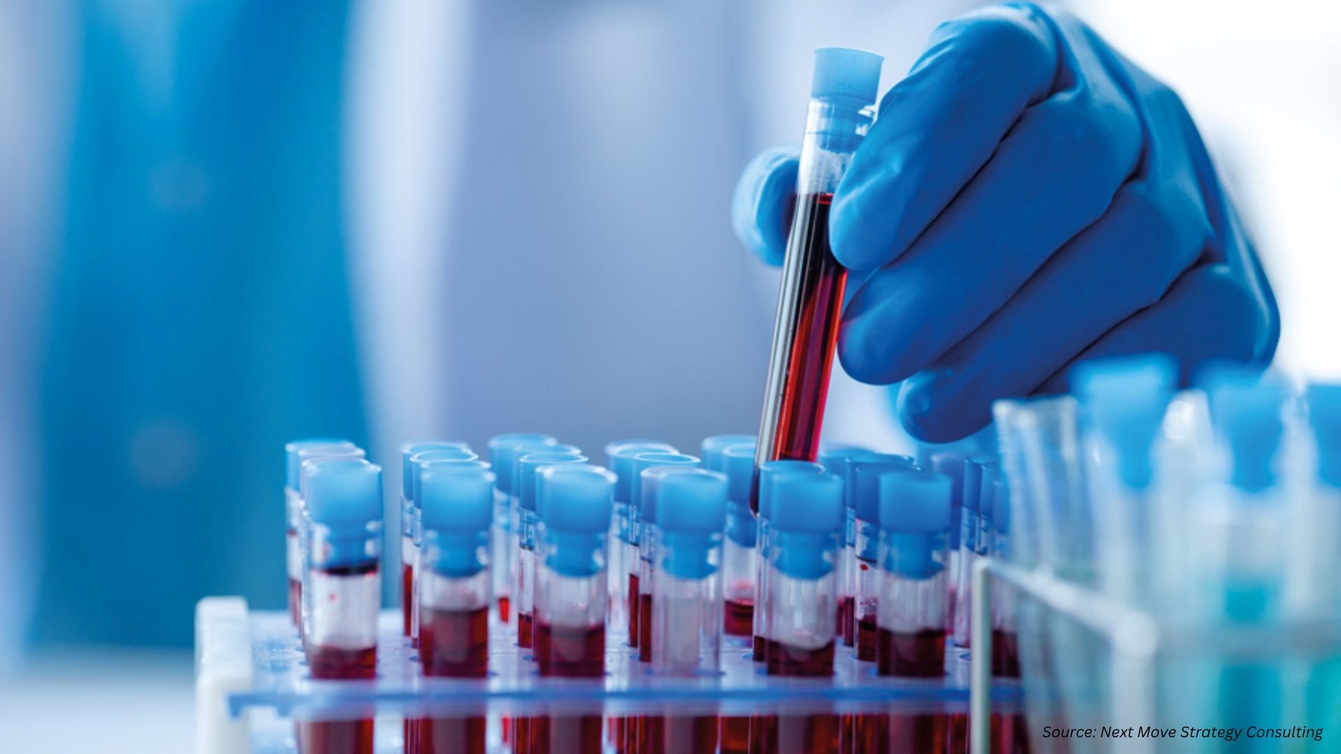 How Sepsis, AMR and Diagnostics Are Reshaping Blood Cultures