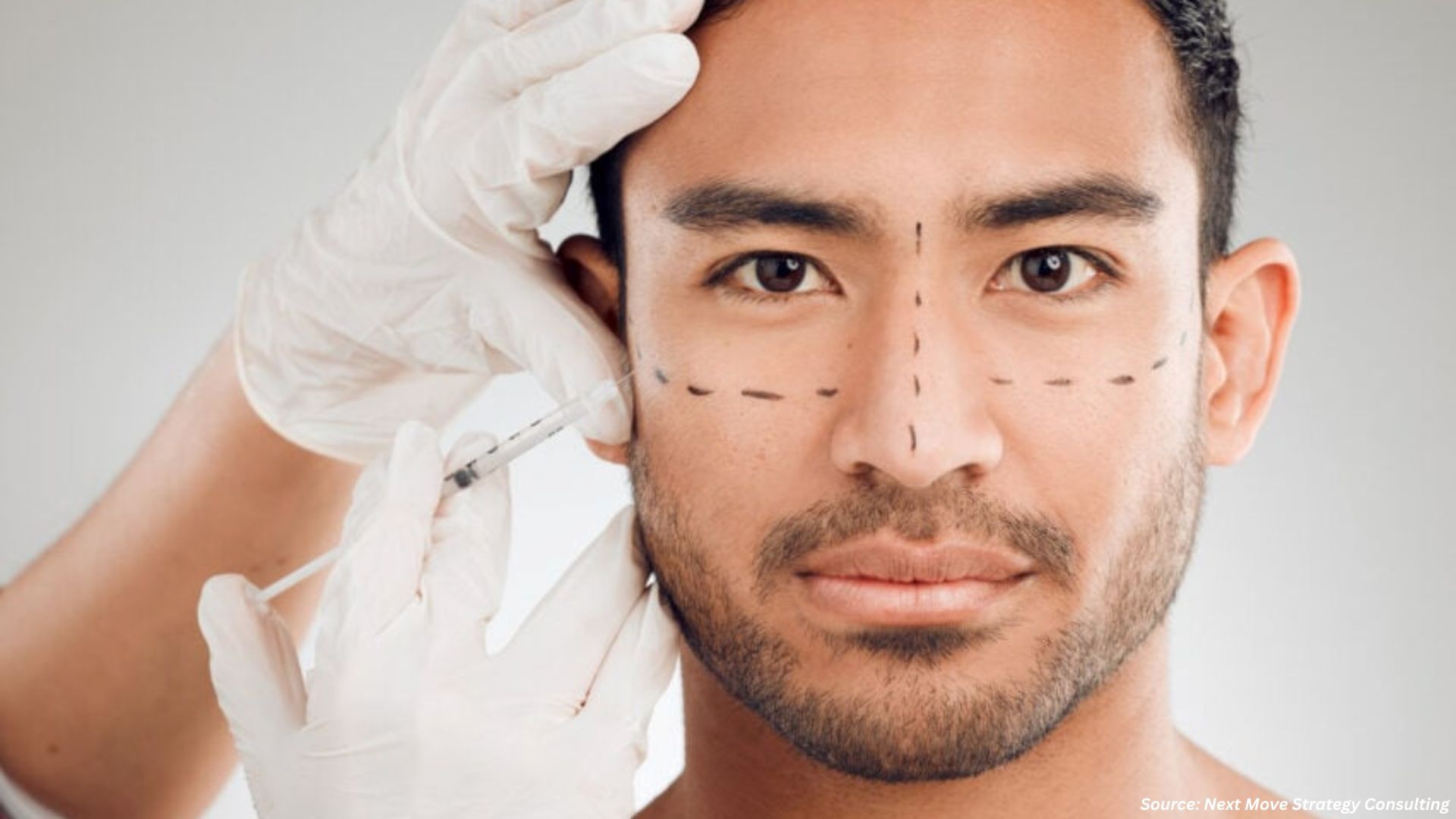 Botulinum Toxin Market Set for USD 11.68 Billion by 2030
