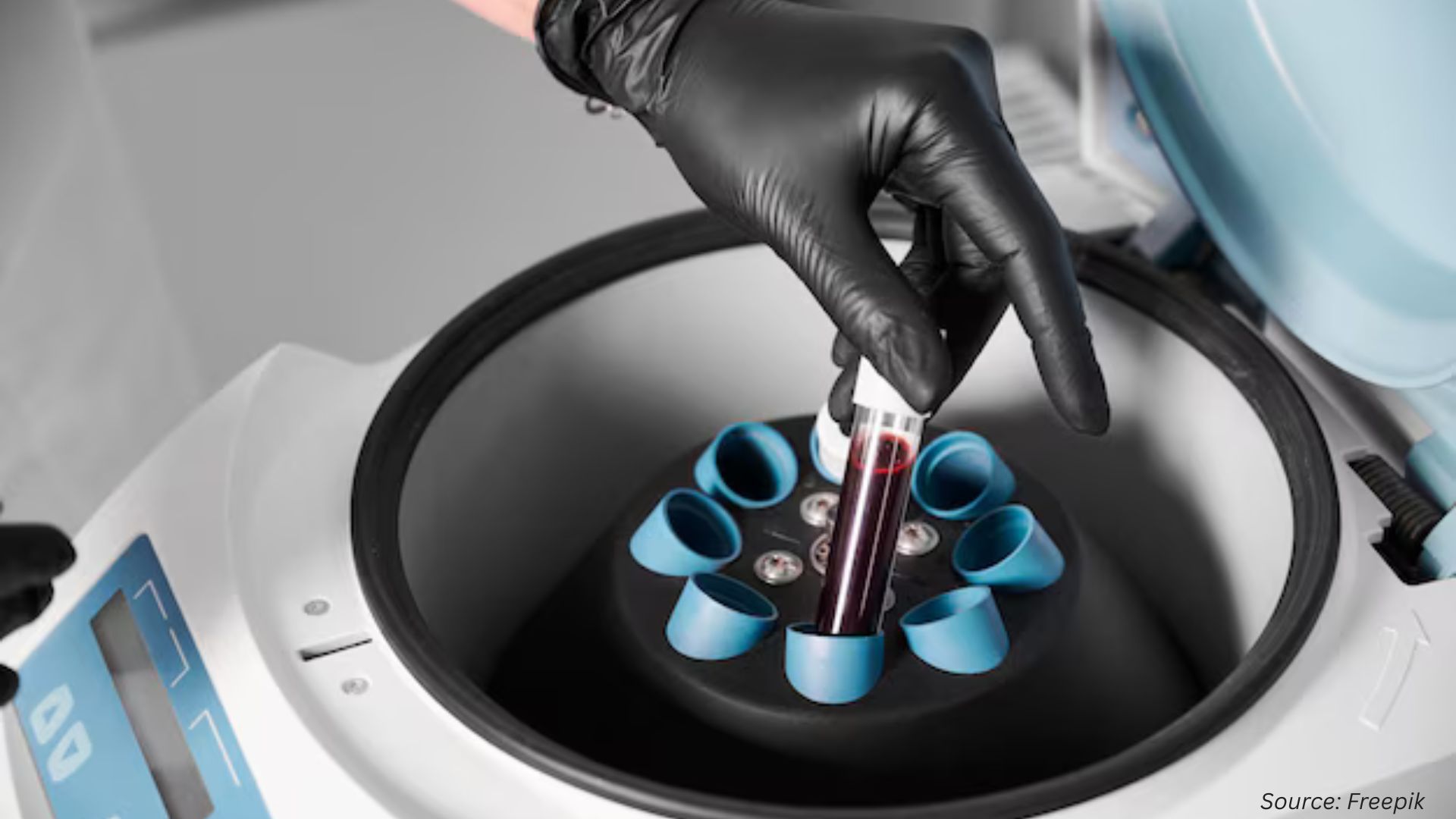Centrifuge Market Trends in 2025: Balancing Innovation and Global Challenges