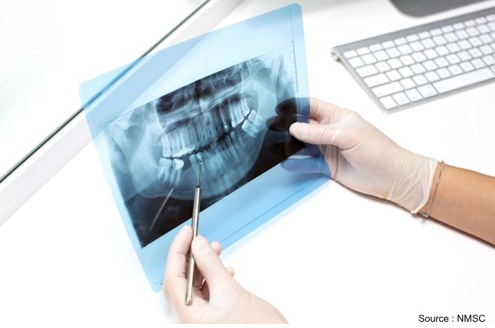 The Cone-Beam Computed Tomography (CBCT) Systems Market is Expected to Reach USD 3.45 billion by 2030