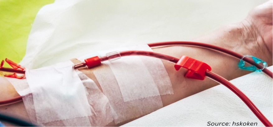 Top 5 Innovations Transforming the Dialysis Market...