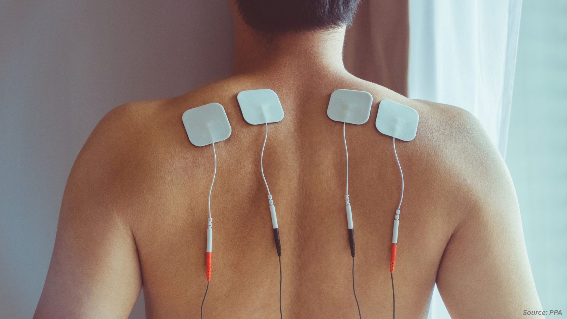 Neuromodulation Market: Clinical Validation, Innovation & Expansion