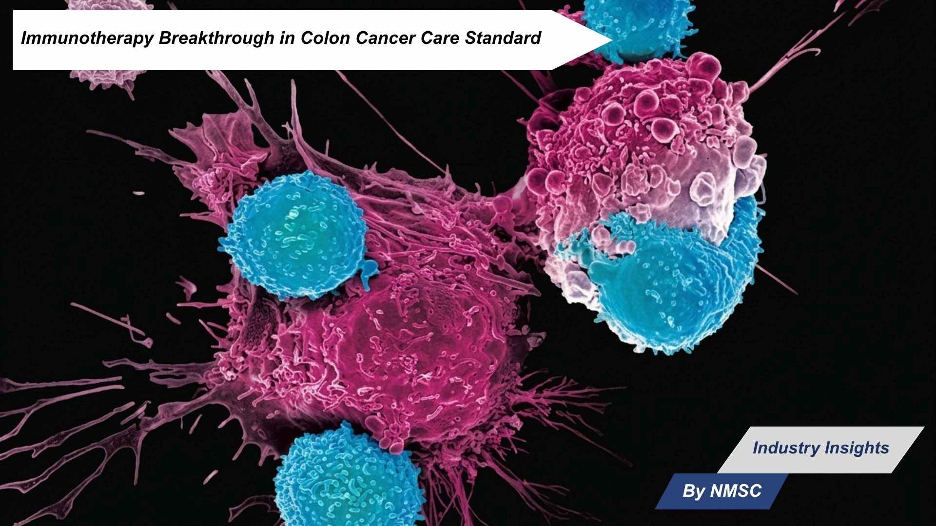 Immunotherapy Breakthrough in Colon Cancer Care Standard