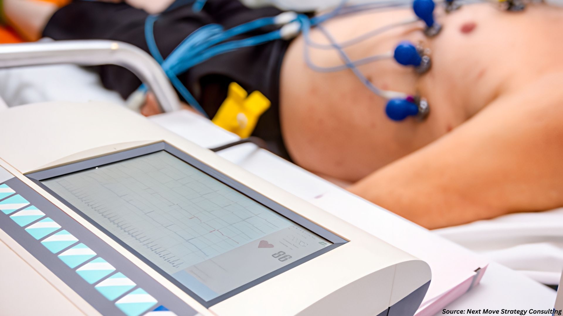 How Is Electrocardiograph (ECG) Transforming Cardi...