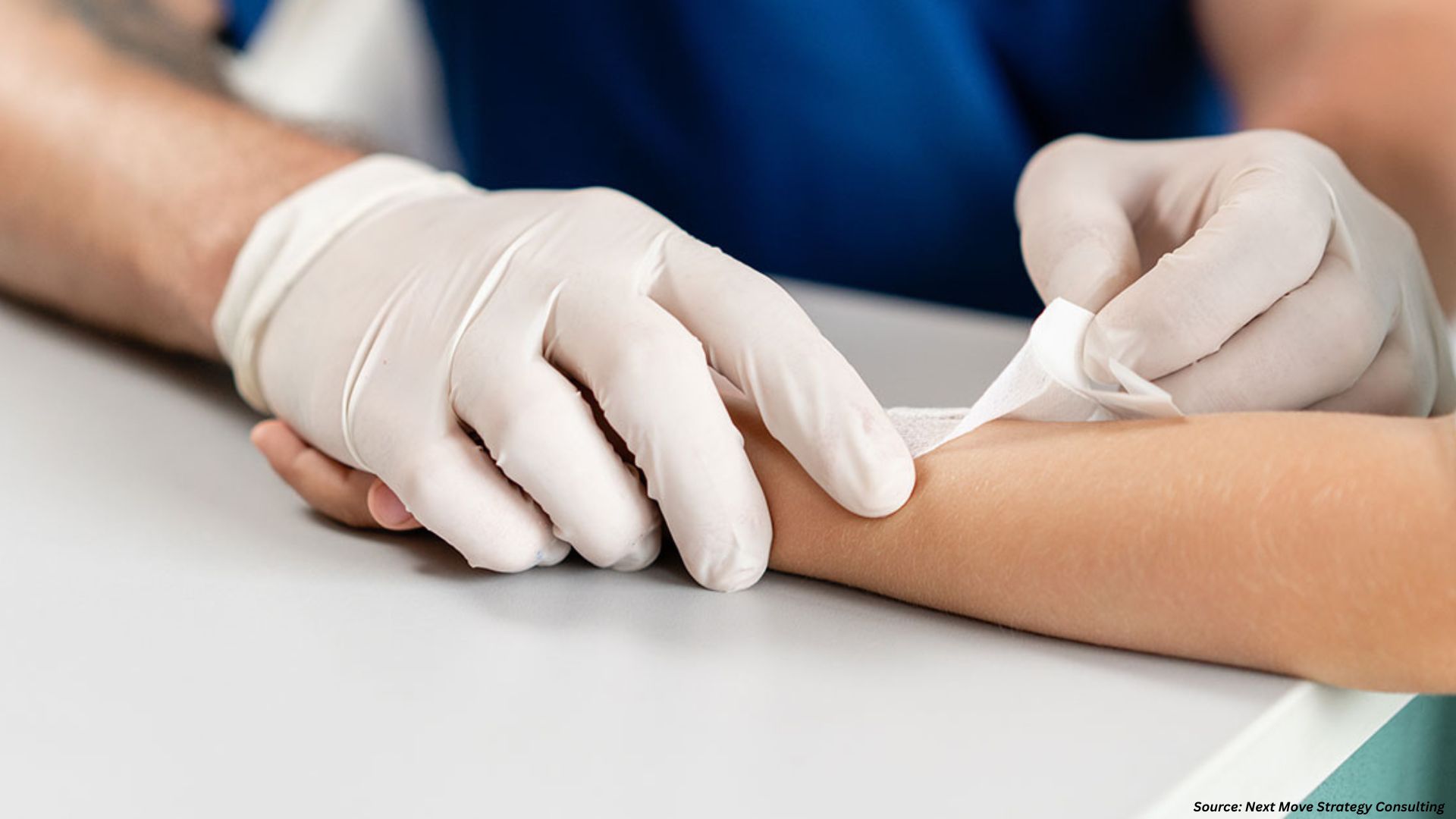 Are Smart Hydrogels the Future of Wound Healing?