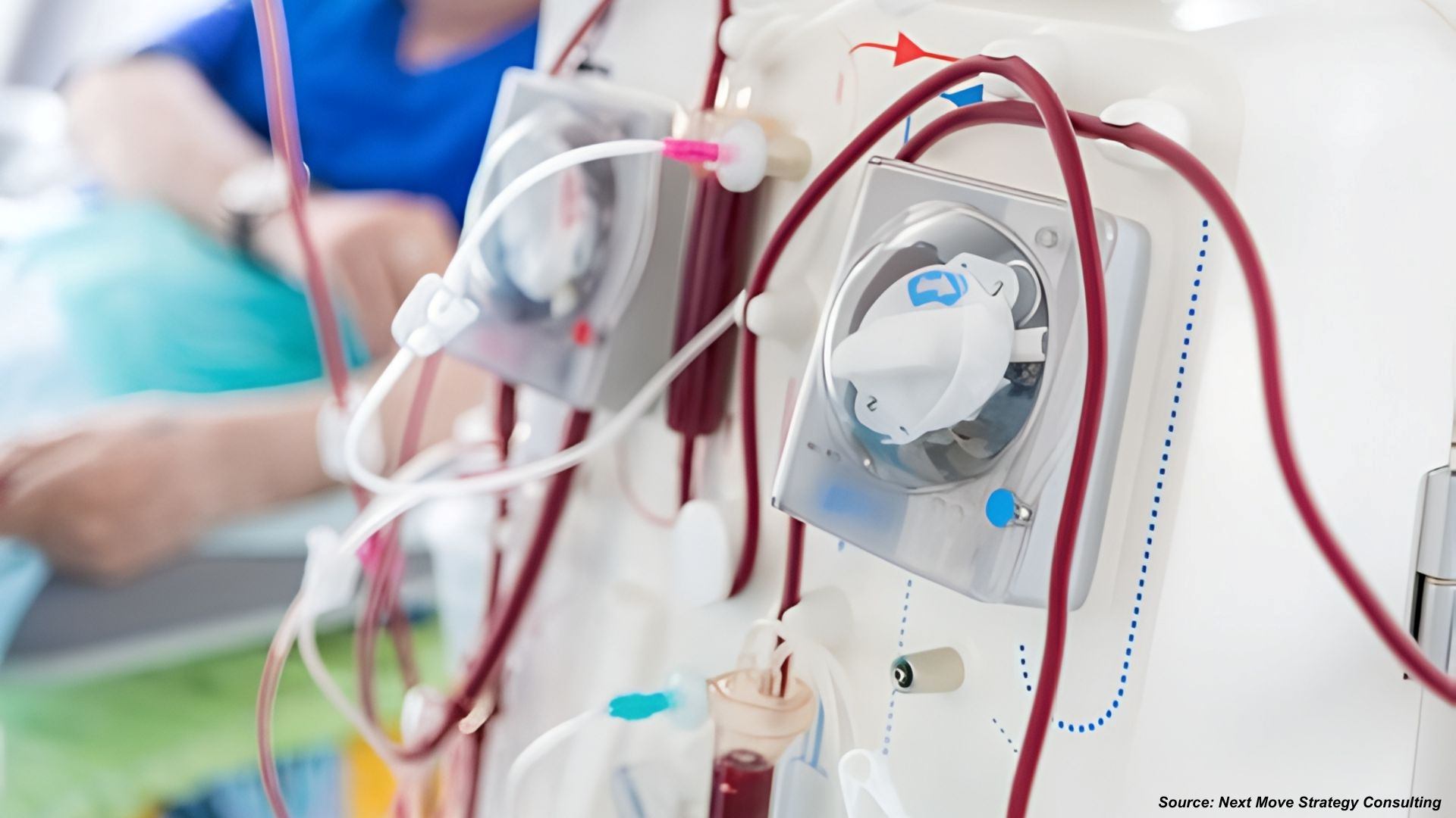 Is the Hemodialysis Industry Entering a New Phase of Supply Resilience and Innovation?