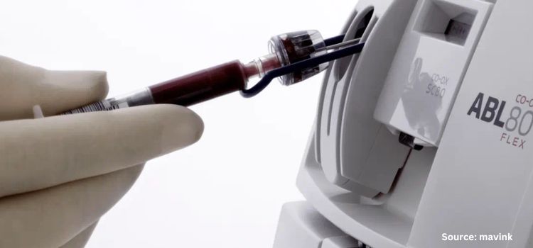 How Tech is Advancing Blood Gas Analyzer Market