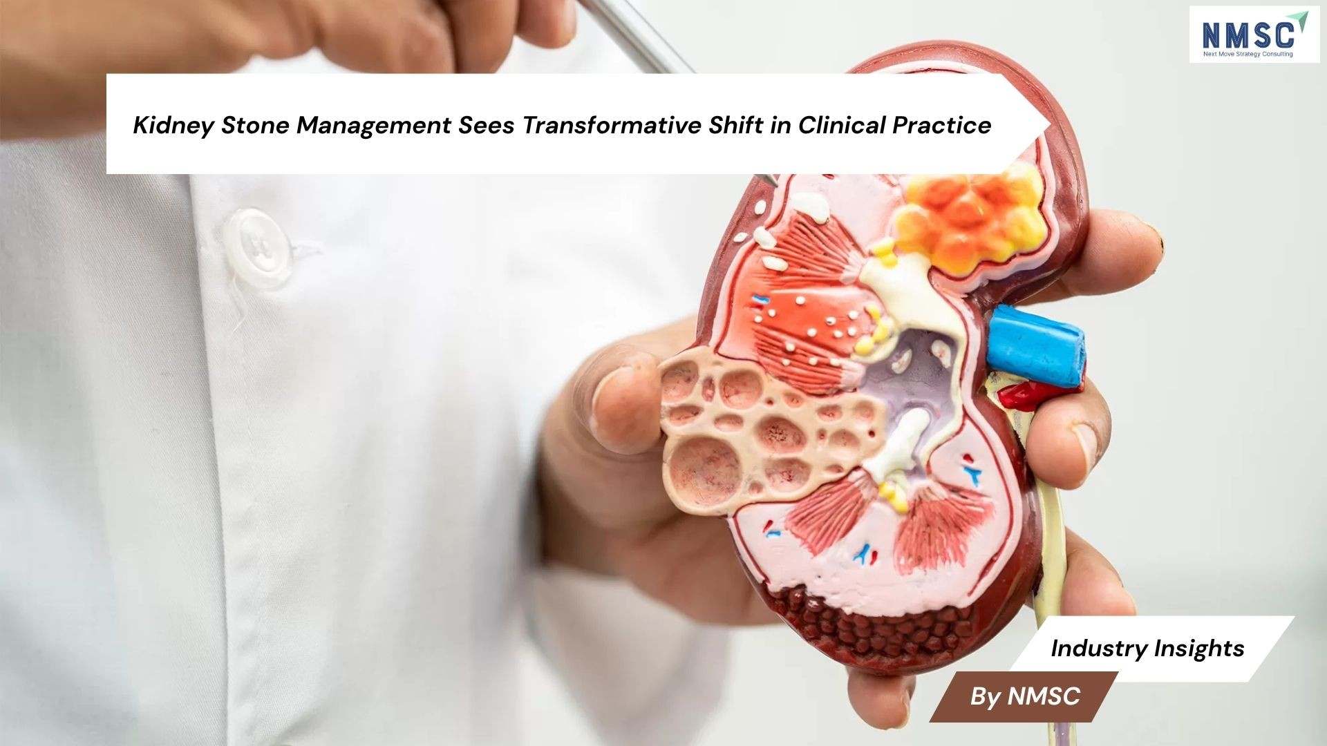 Kidney Stone Management Sees Transformative Shift in Clinical Practice