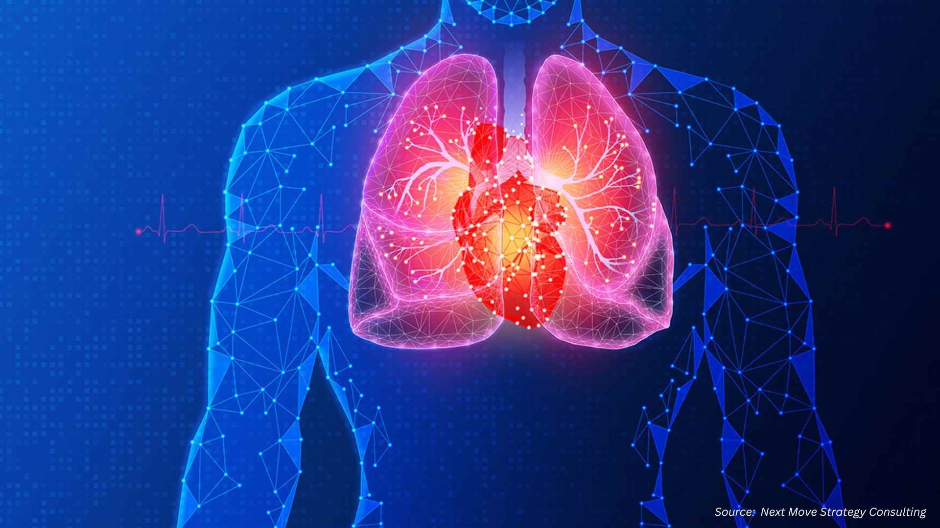 Lung Cancer Diagnostics: AI, Screening & Market Trends