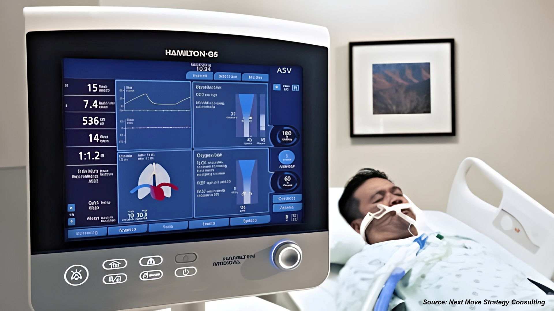 Mechanical Ventilators Market: AI and FDA Recalls...