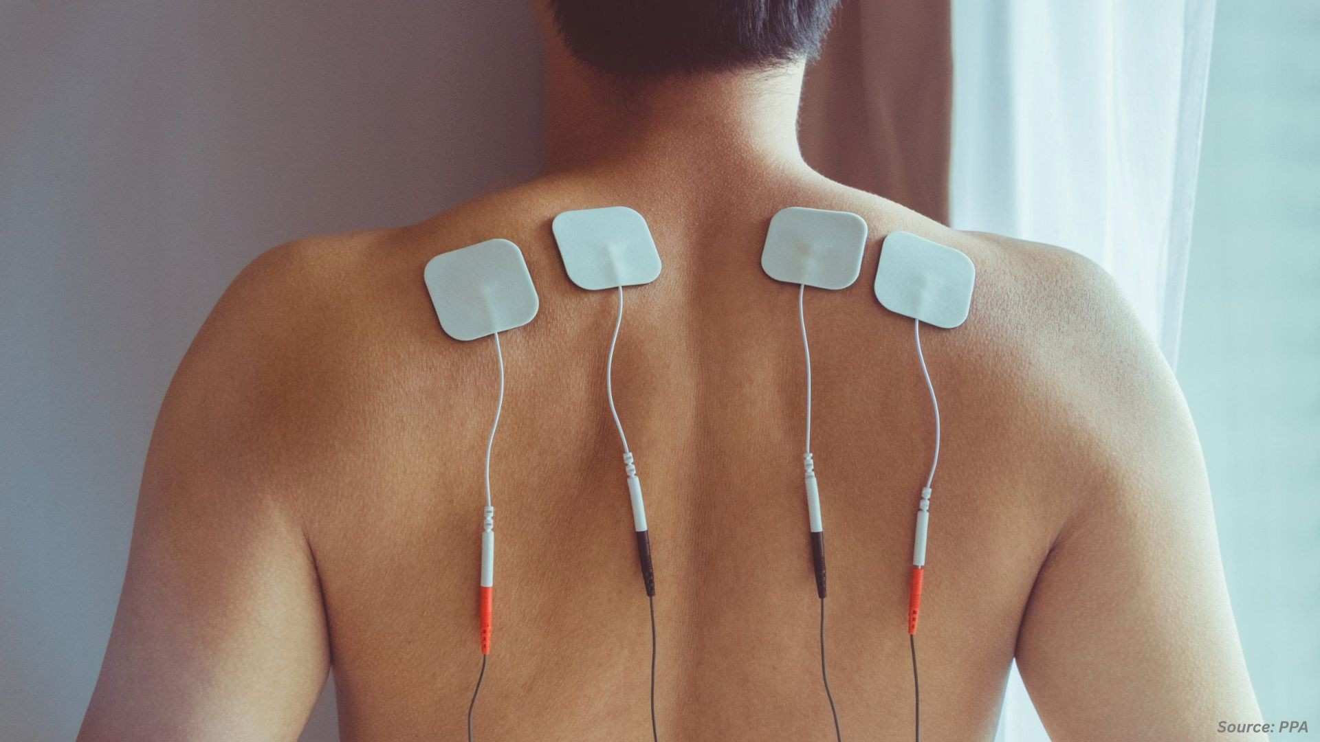 Neuromodulation Market: Clinical Validation, Innovation & Expansion