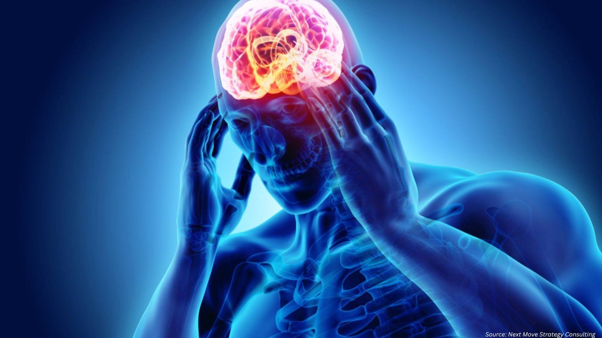 Migraine Drugs Market Advances with New Therapies and Breakthrough Targets