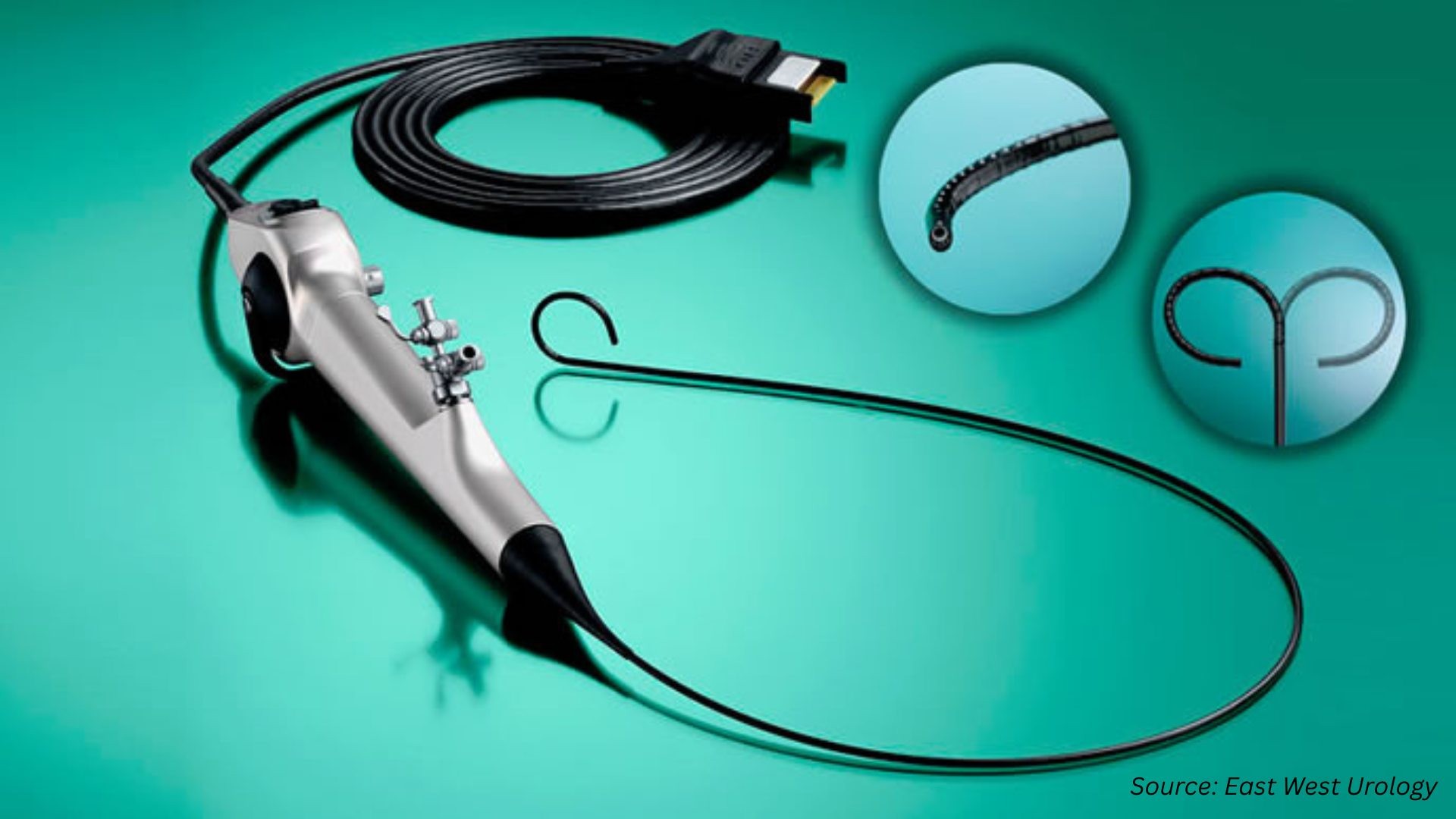 Advancements in Ureteroscope Technology and Innovation