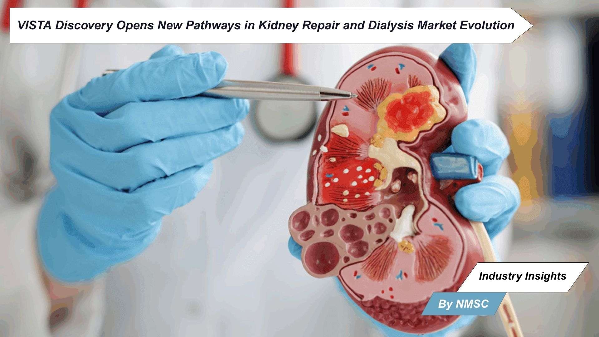 VISTA Discovery Opens New Pathways in Kidney Repair and Dialysis Market Evolution