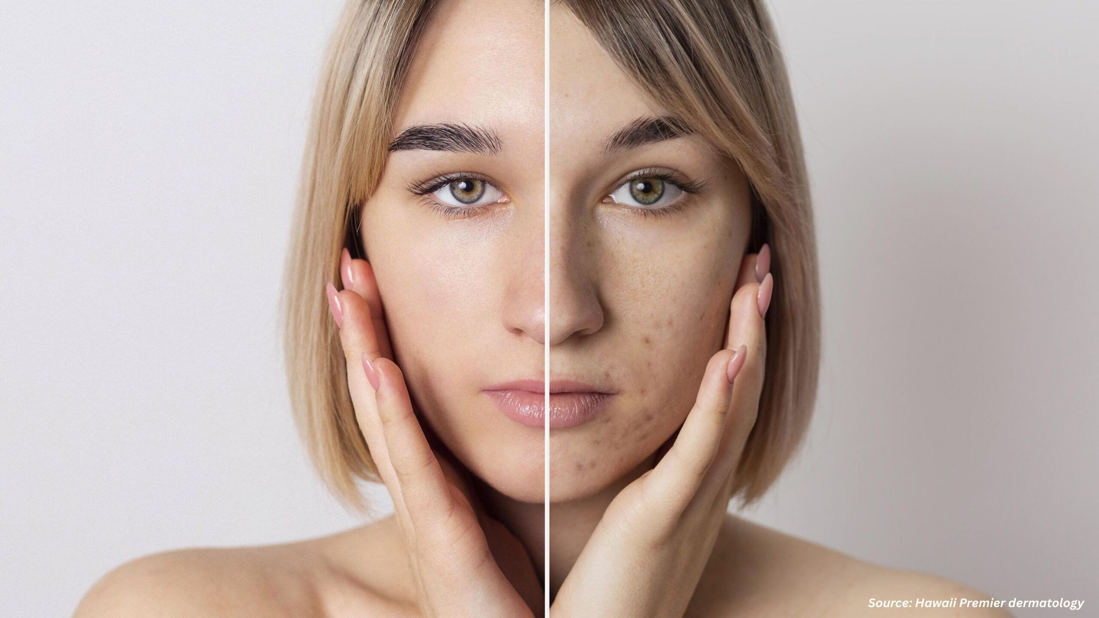 Top 5 Innovators Revolutionizing Acne Treatment Today