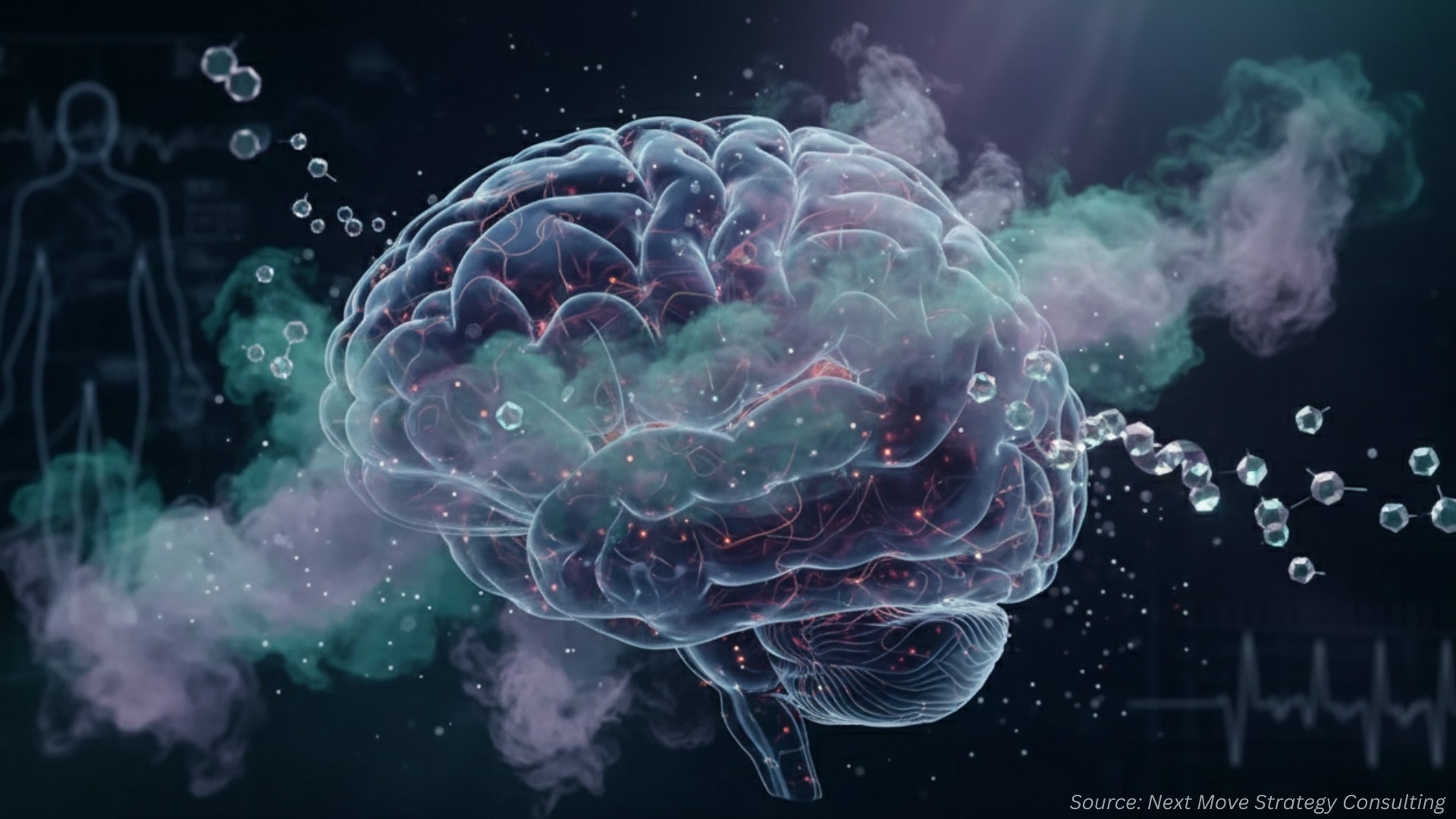 Propofol, Nebulized Dexmedetomidine and a Surprising Epilepsy Lead - What’s Next for the Anesthesia Drugs Market?