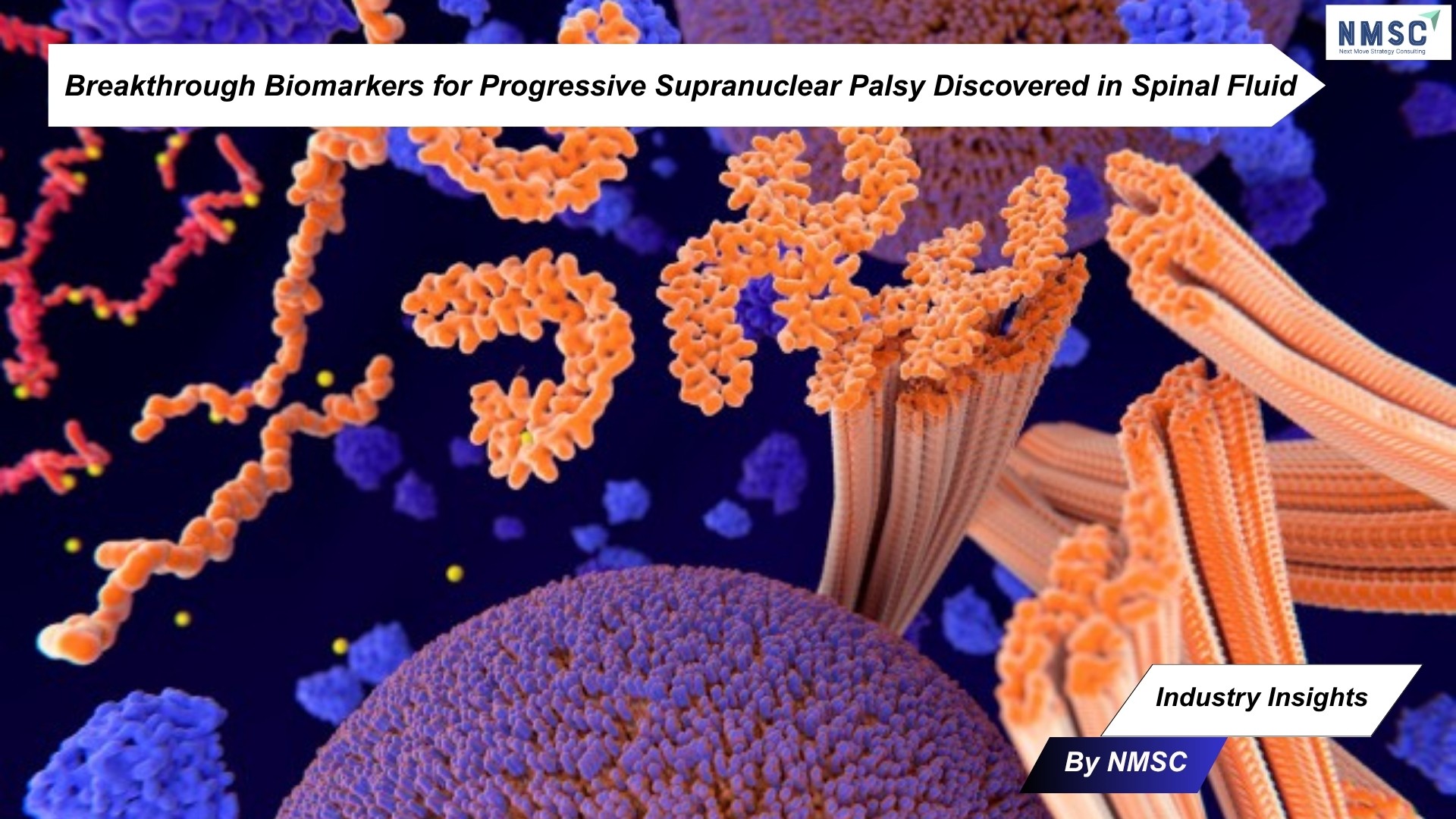Breakthrough Biomarkers for Progressive Supranuclear Palsy Discovered in Spinal Fluid