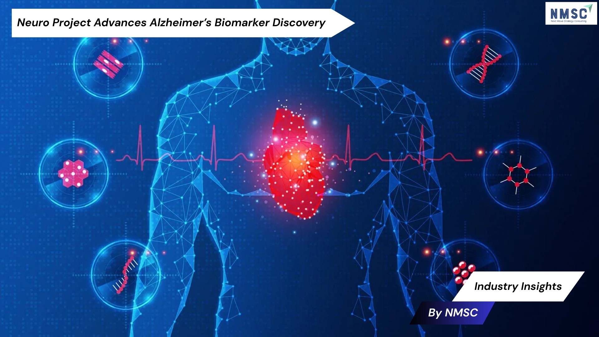 Neuro Project Advances Alzheimer’s Biomarker Discovery