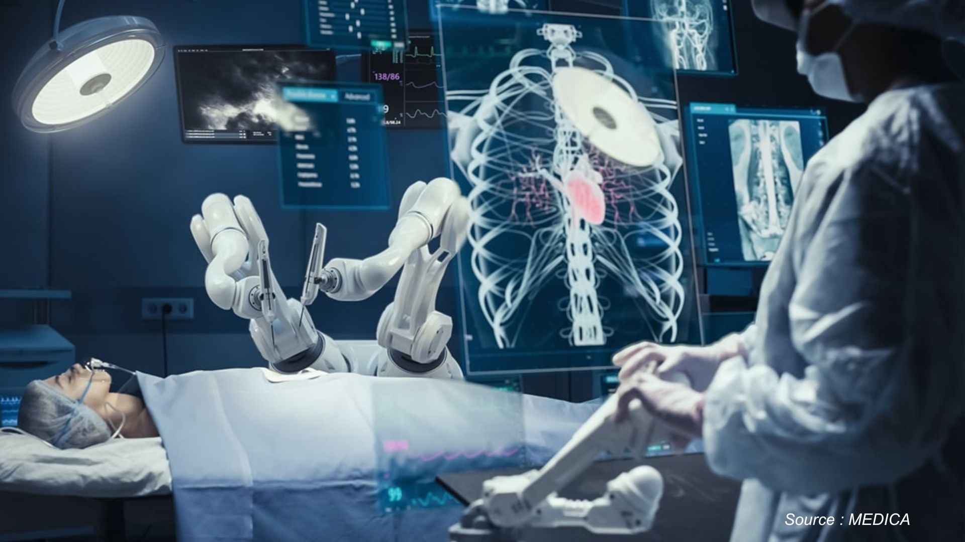 Top 5 Emerging Trends Transforming the Medical Robotics Market in 2025