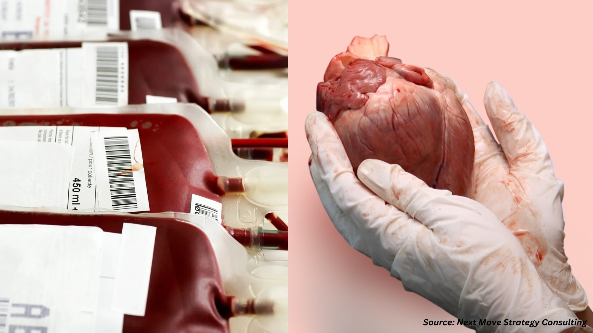 Emerging Trends in Blood and Organ Banks