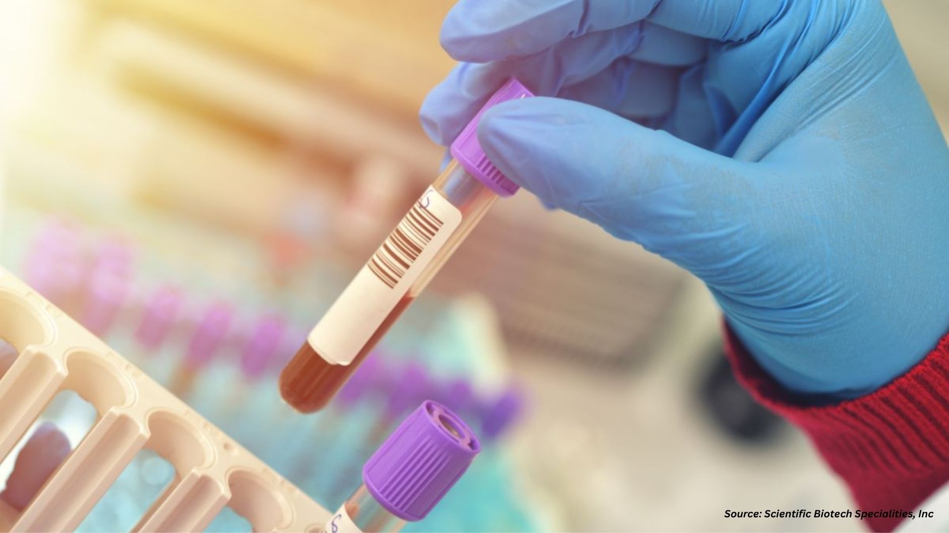 How Companies Shape the Blood Gas Analyzer Market
