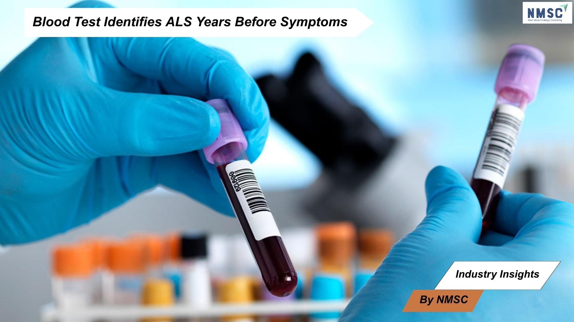 Blood Test Identifies ALS Years Before Symptoms