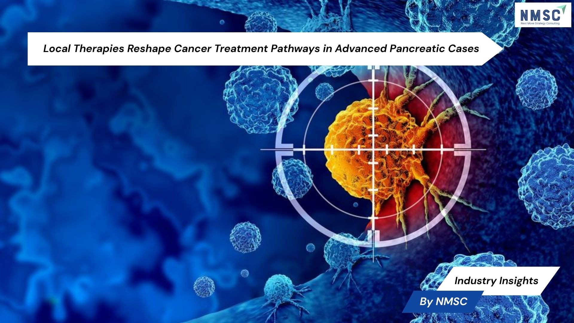 Local Therapies Reshape Cancer Treatment Pathways in Advanced Pancreatic Cases