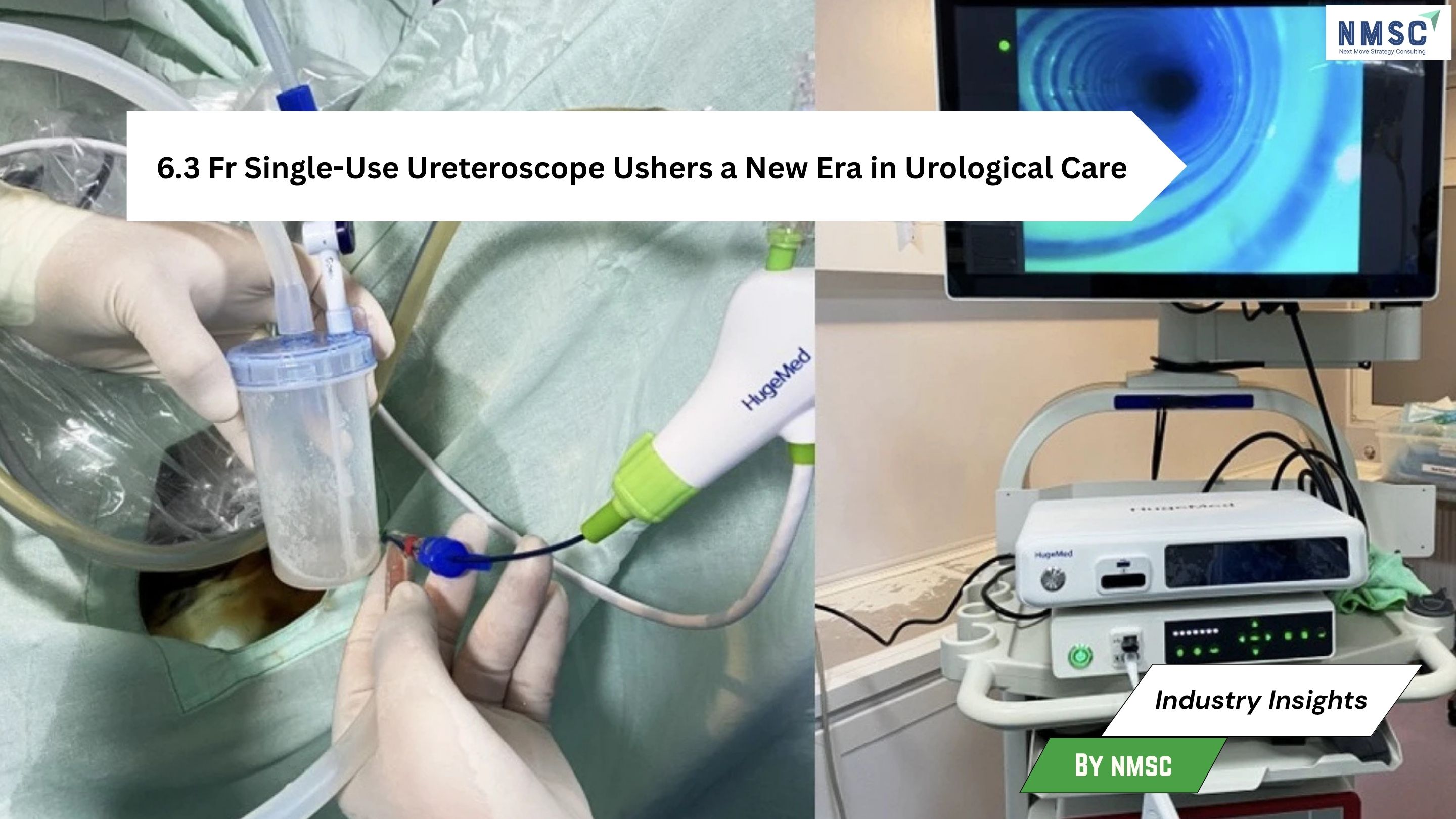 6.3 Fr Single-Use Ureteroscope Ushers Clinical Advancement