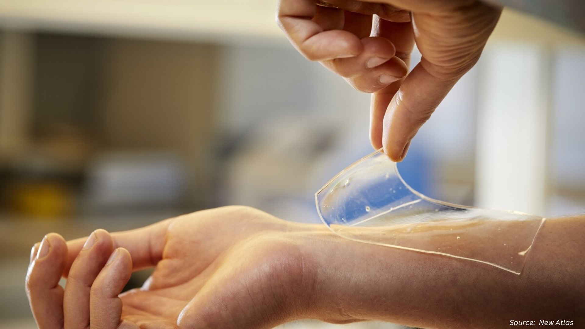 Hydrogel Dressings: AI, Natural Bio composites & Green Trends