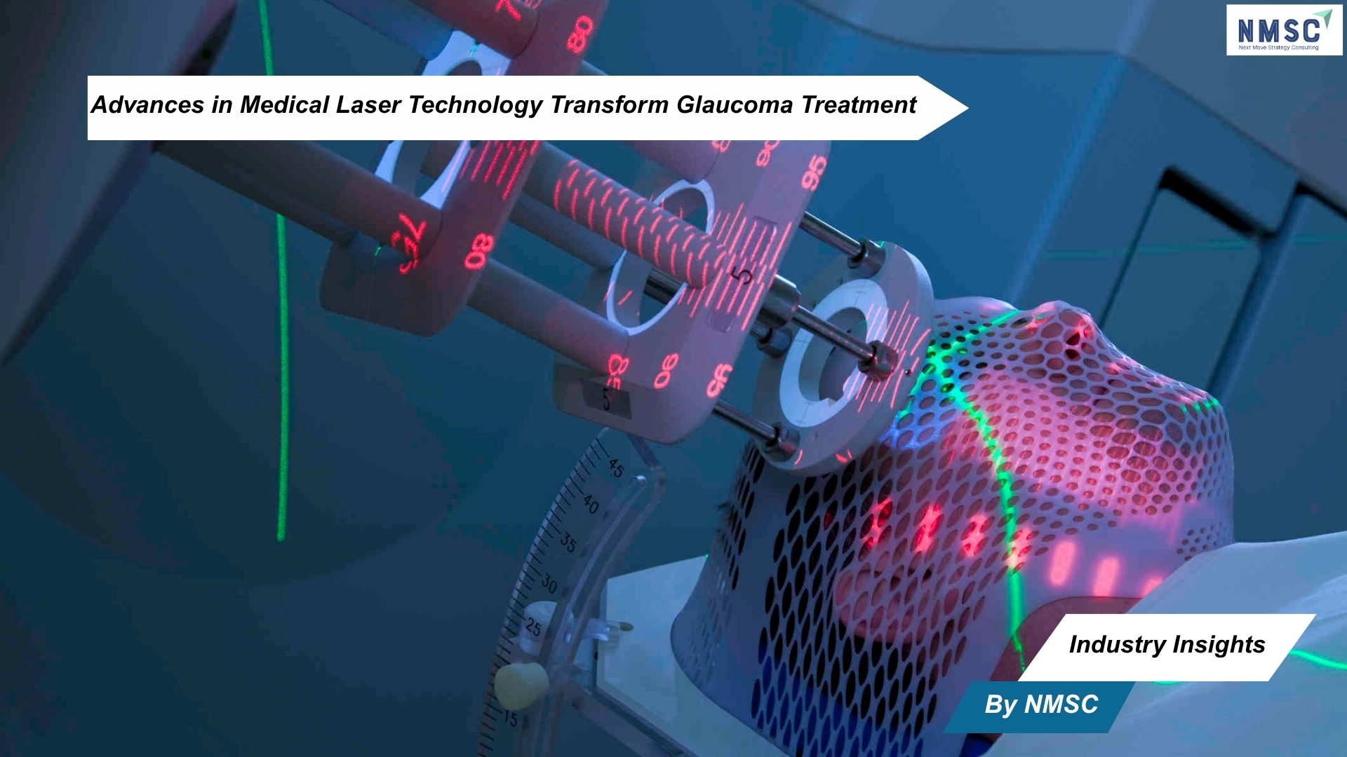 Advances in Medical Laser Technology Transform Glaucoma Treatment