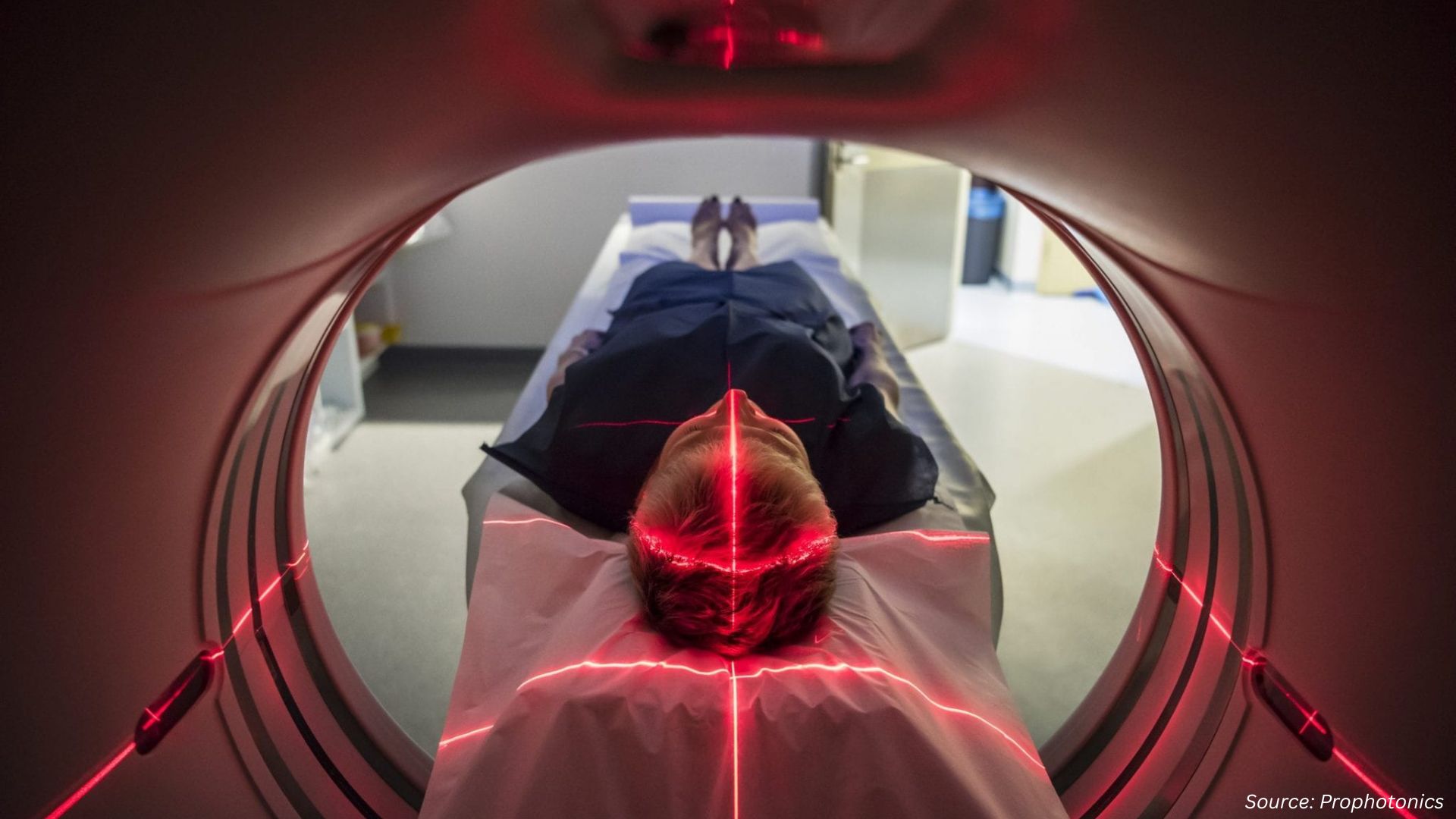 Medical Lasers Market: Clinical Breakthroughs and Investments Power Next-Gen Healthcare