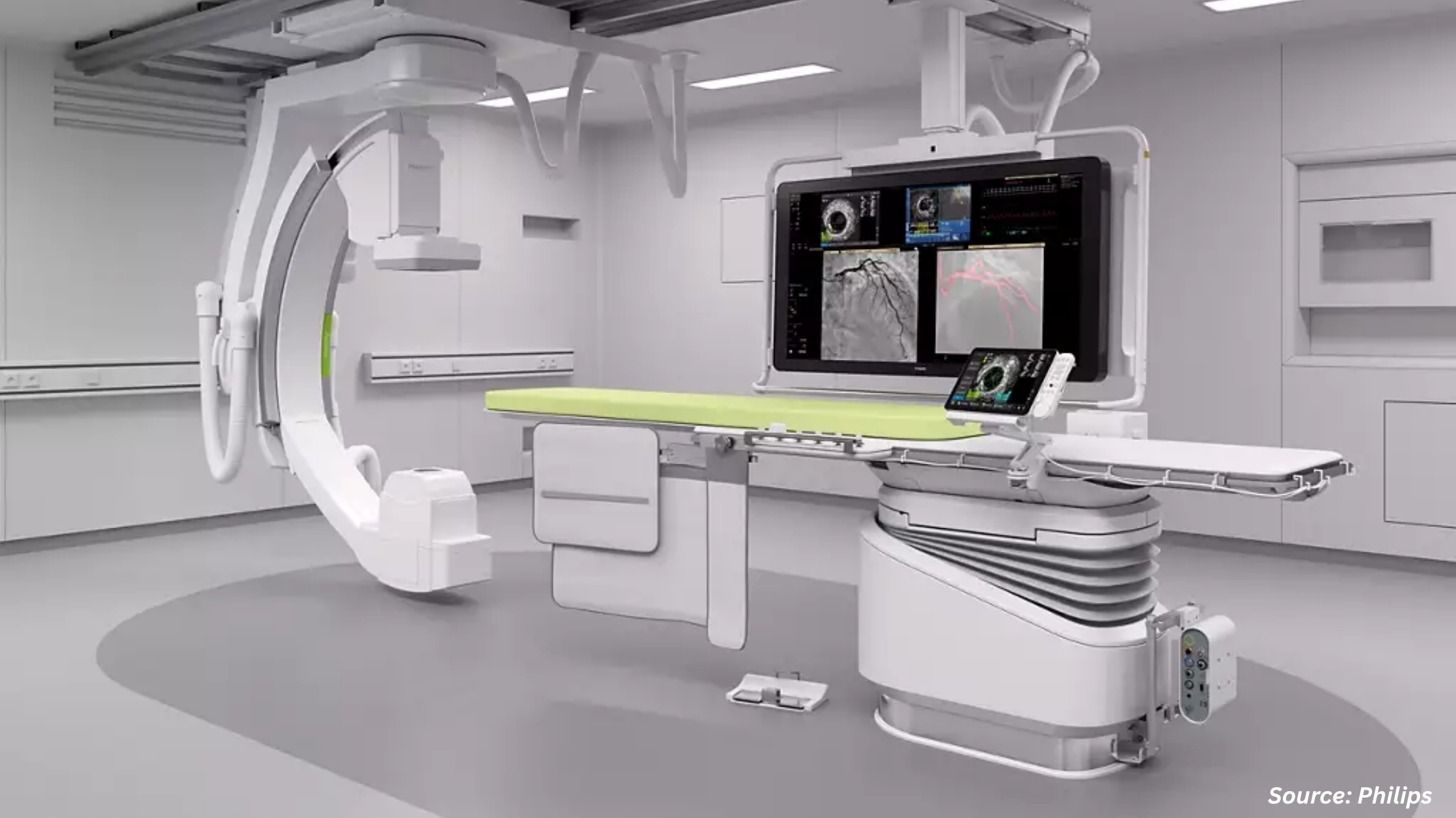 Revolutionizing Cancer Imaging with Philips’ CBCT System